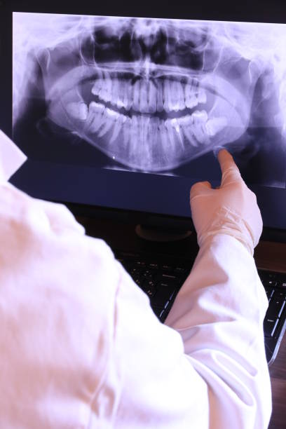 Best Emergency Wisdom Teeth Removal in Leisure World, MD